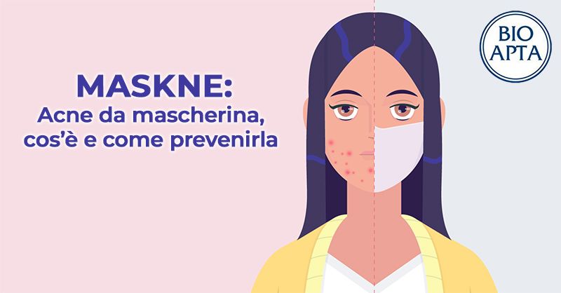 MASKNE: lacne da mascherina